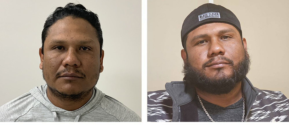 Beard Hair Transplant Before and After in Miami