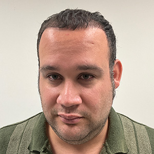 Eduardo Frómeta hair transplant 4 month after