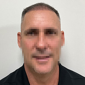 José Luis hair transplant 4-month-after photo