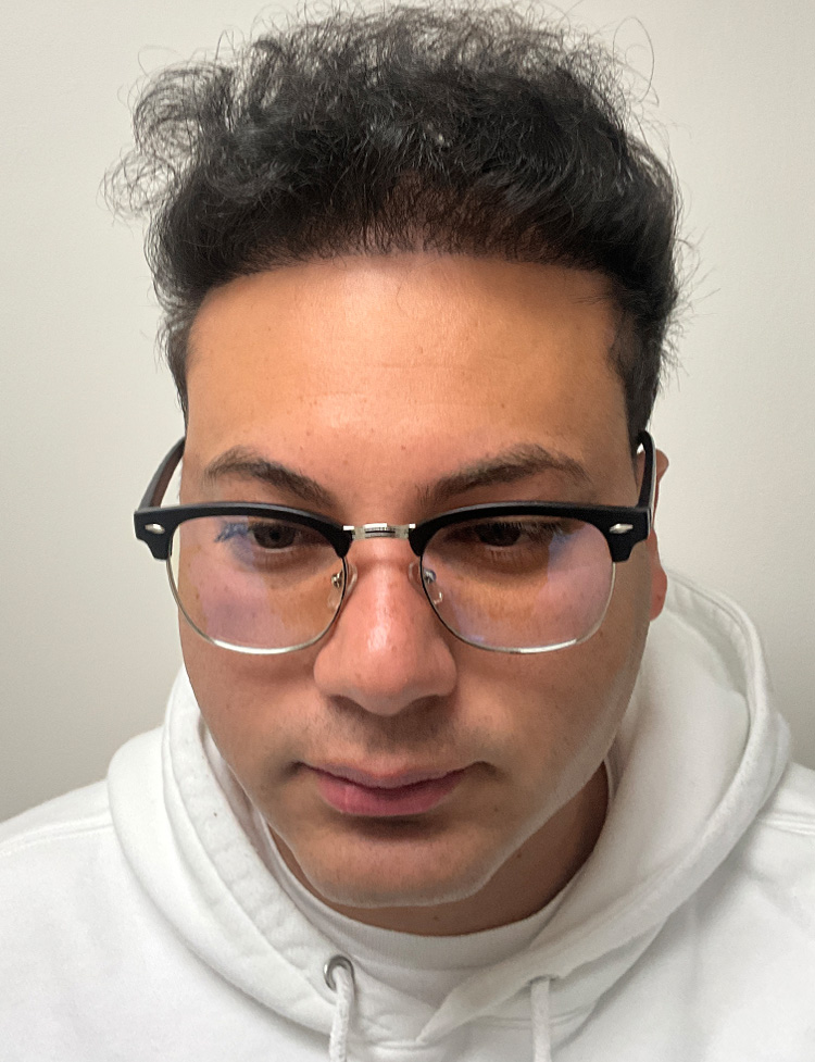 restauración del cabello despues