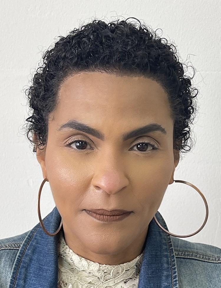 Female hair restoration in Miami after photo