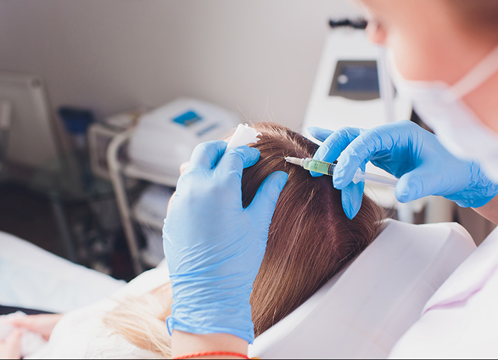 Terapia con Células Madre Para la Caída del Cabello