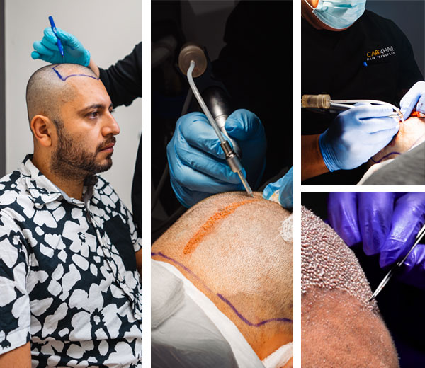 out of town and travelling patients at care4hair