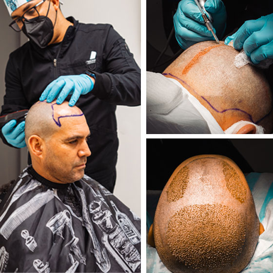 miami location patient