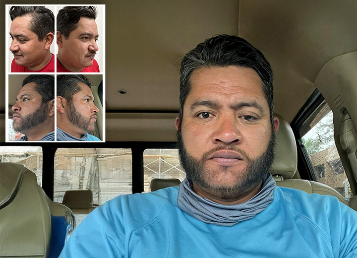 Beard reconstruction from scratch