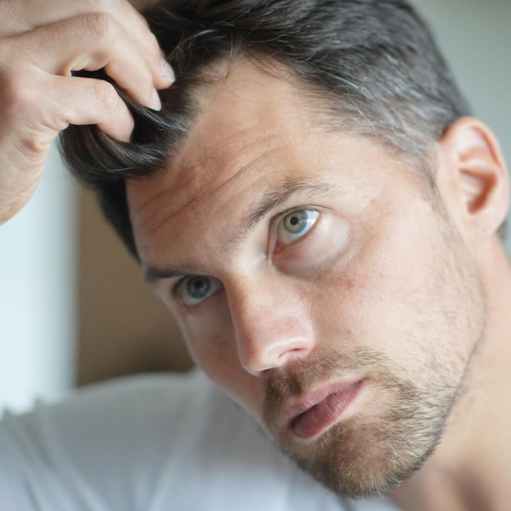 hairline restoration