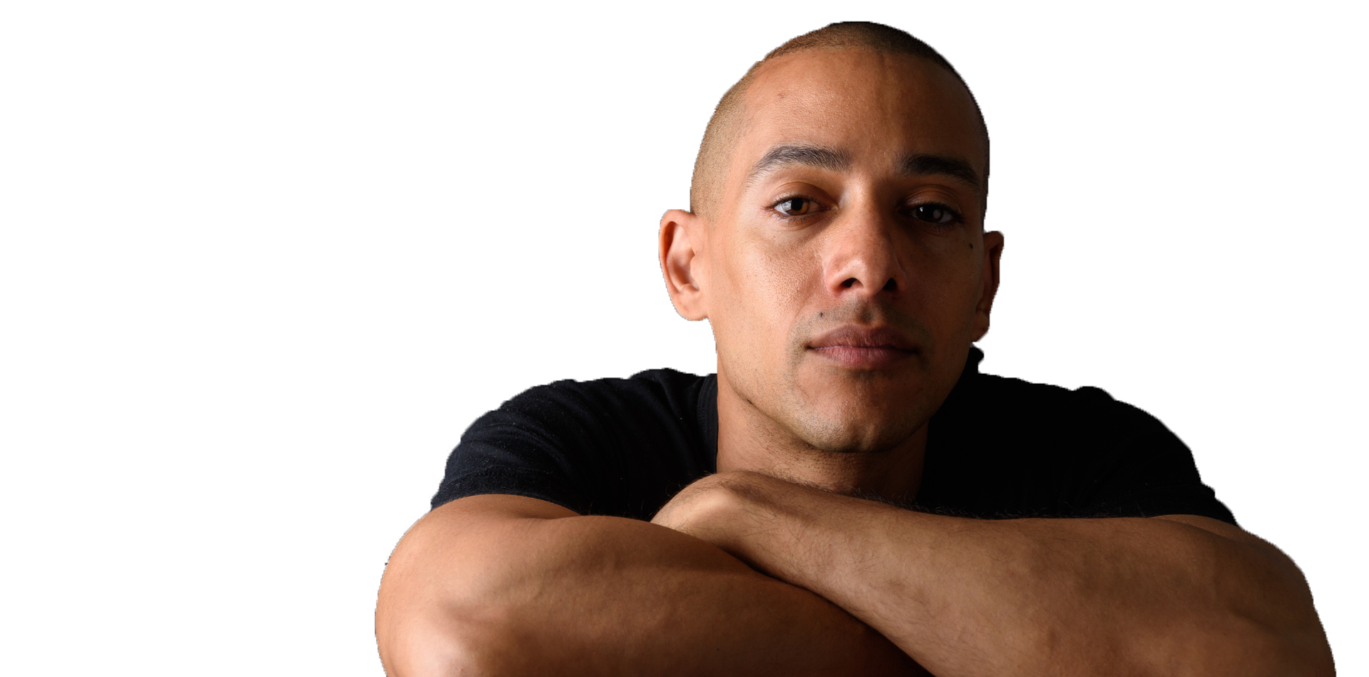 scalp micropigmentation for men and woman