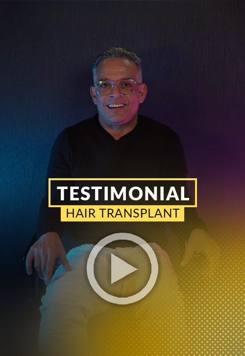 Alexandro Noguera testimonial after his hair restoration in Miami