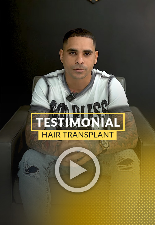 Carlos Alberto testimonial after his hair restoration in Miami