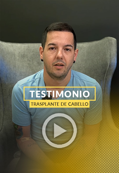 Video Testimonio de Carlos Paciente de Trasplante de Cabello