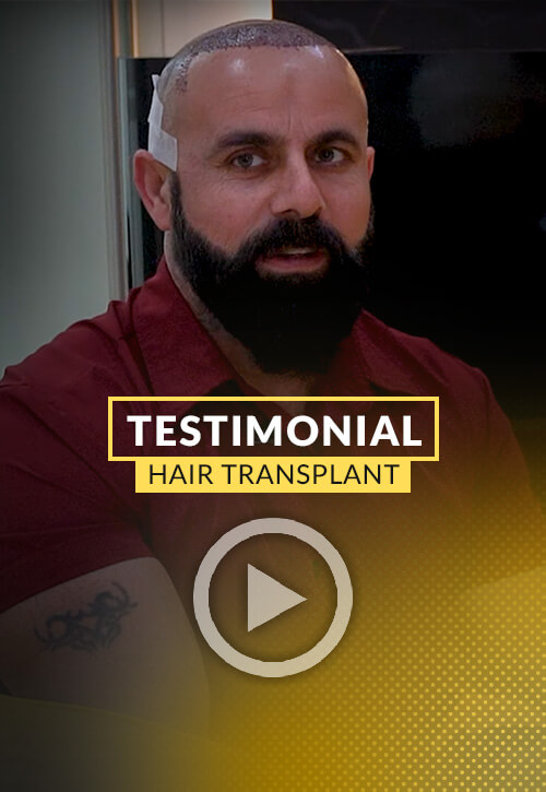 Testimonial of one of our patients about his surgery in CARE4HAIR