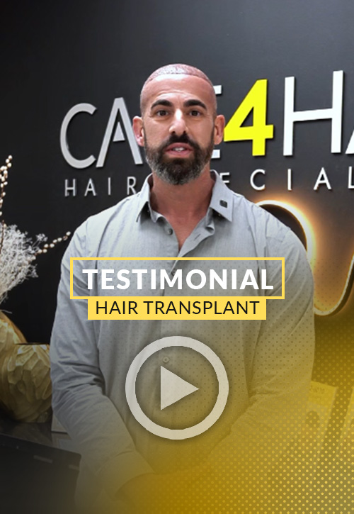 Christopher Testimonial after his hair restoration in Miami | Care4Hair