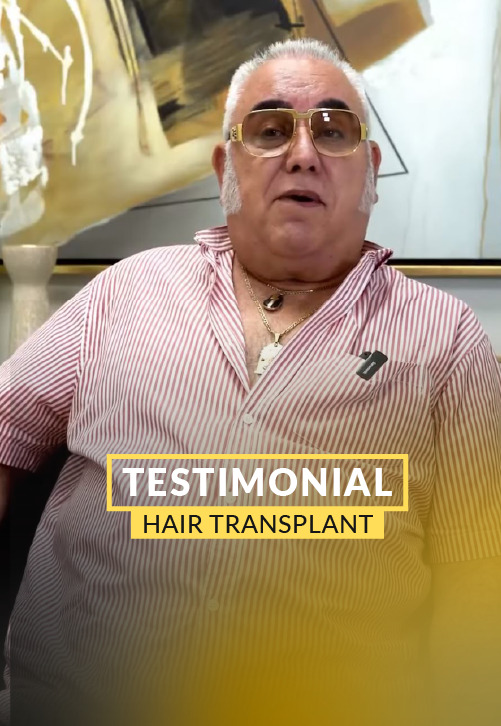 2-Month Hair Transplant Transformation – Video Testimony