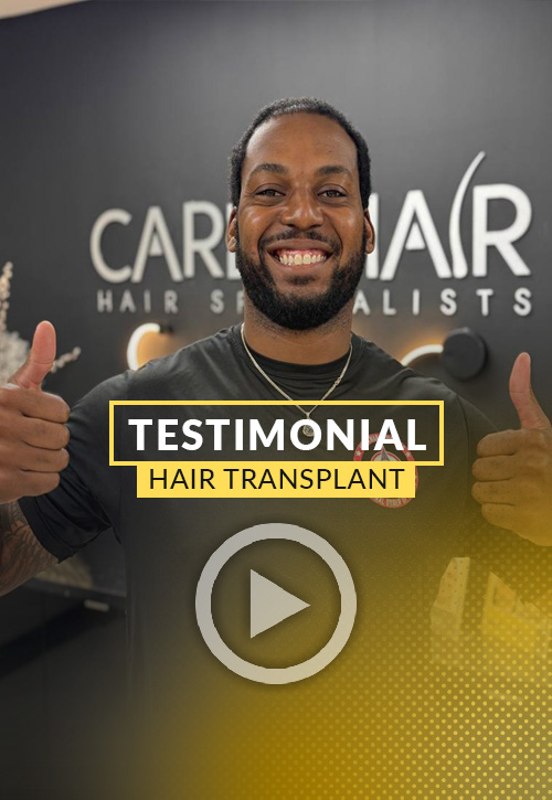 2500-grafts hair transplant video testimonial