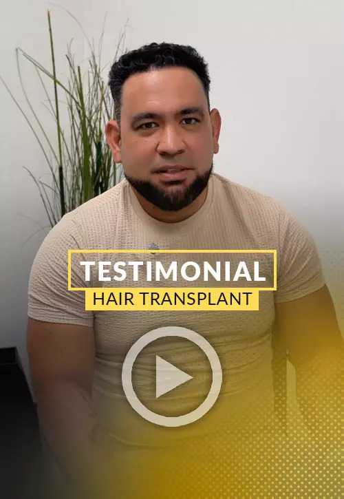 Luis Sanchez Testimonial after his hair restoration in Miami | Care4Hair