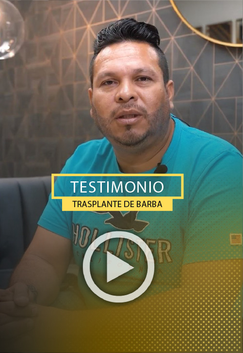 Testimonio de Francisco 10 dias despues del trasplante de barba