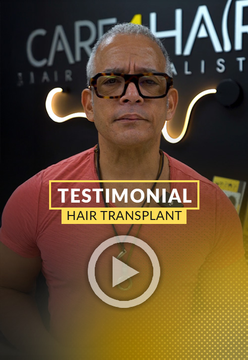 Testimonial after his hair restoration in Miami | Care4Hair