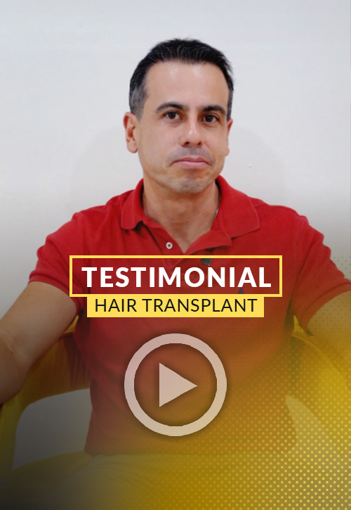 Iván Reyes Testimonial after his hair restoration in Miami | Care4Hair