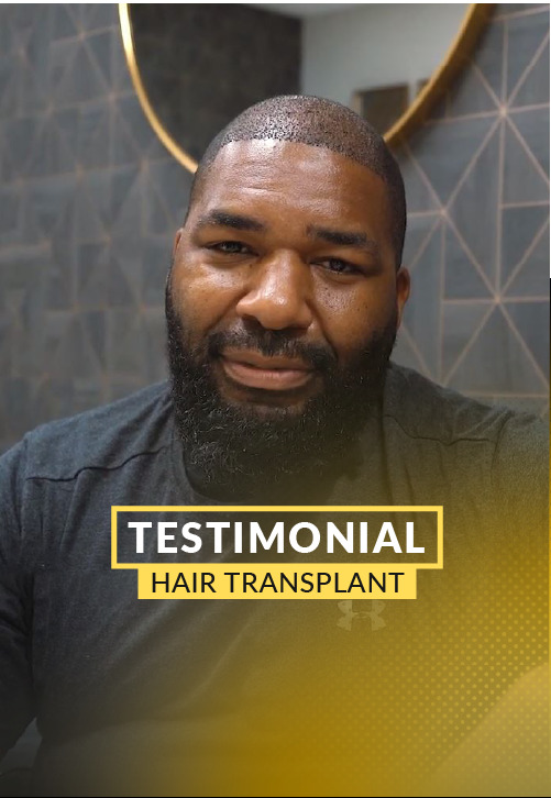 Kenneth Lancaster Hair Transplant Video Testimony - 5 days post-op