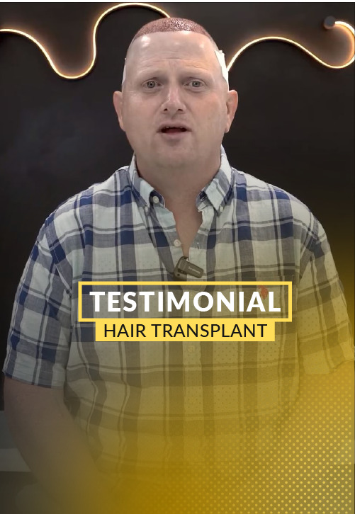 Video Testimony: 3,500 grafts hair transplant surgery – 1 day post-op.