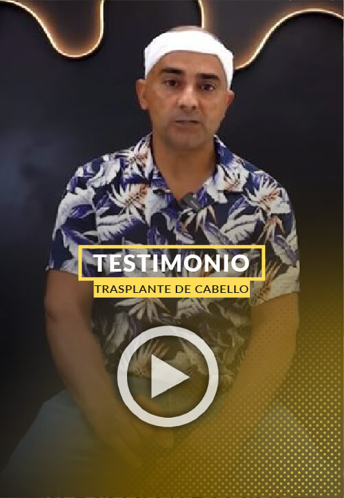Trasplante de Cabello en la zona de la Coronilla - Video Testimonio