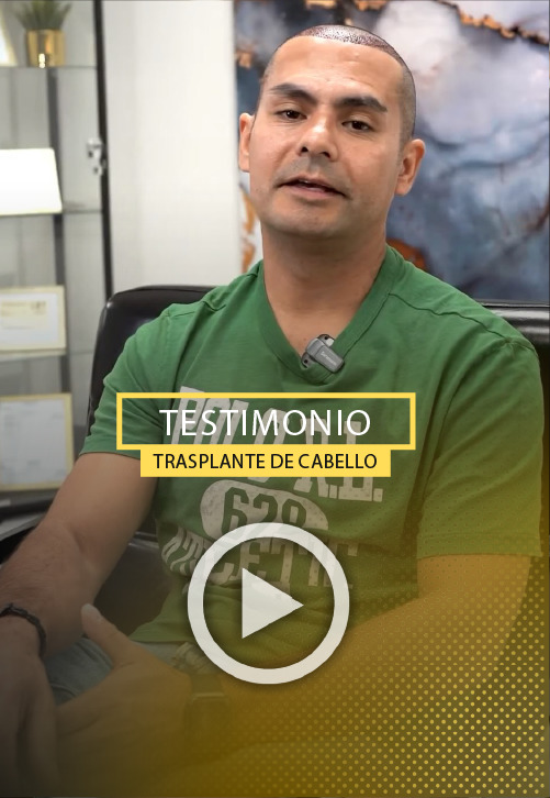 Implante capilar de 2000 foliculos - Video Testimonio