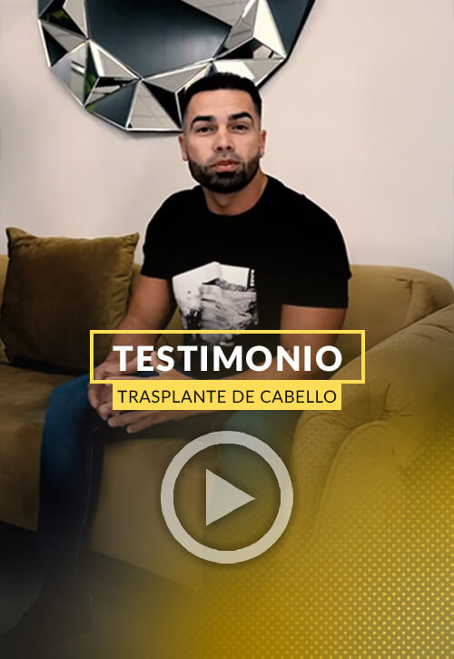 Testimonio de paciente despues de 5 meses del trasplante de cabello