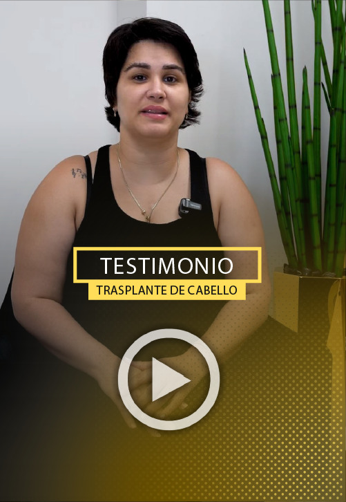 Trasplante de cabello Femenino de 1800 injertos - Video Testimonio.