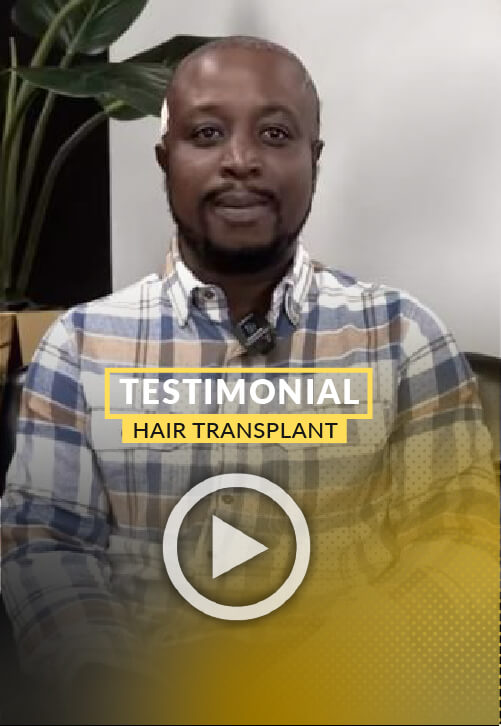 Patient Testimonial Video - 2000 grafts to restore hairline zone