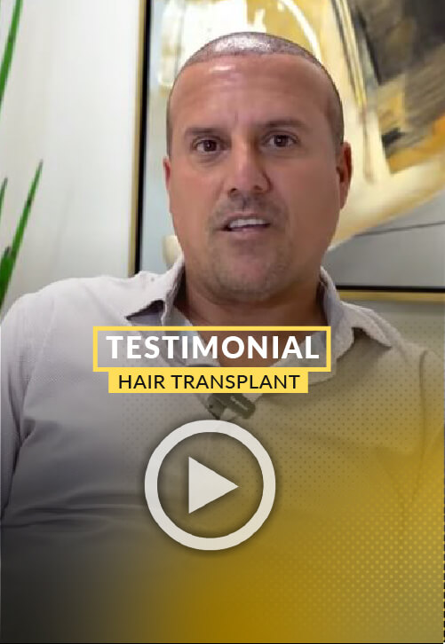 3500-grafts hair transplant surgery Video Testimonial