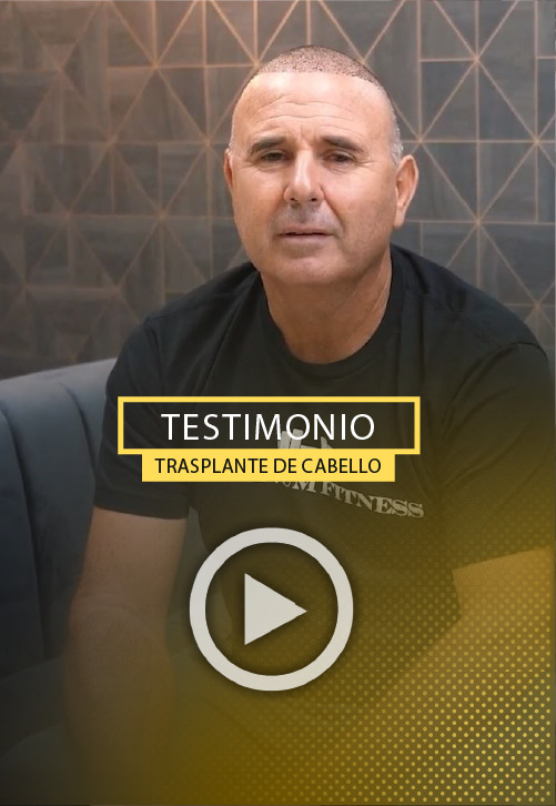 Restauracion de la linea frontal del Cabello - video Testimonio