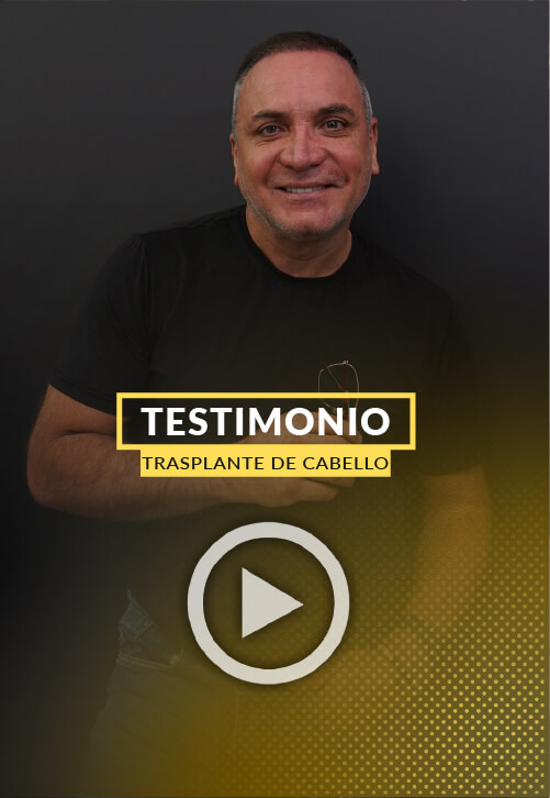 Procedimiento de 35000 implantes de pelo - Video Testimonio.