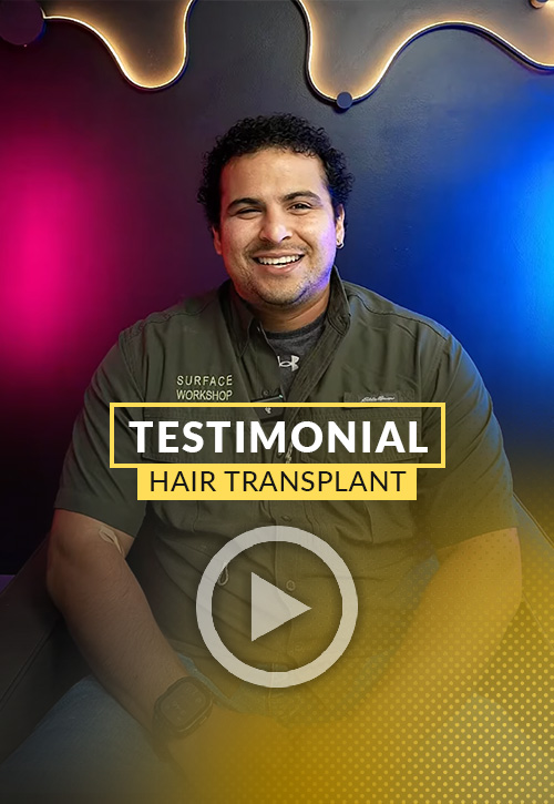 Juan Pablo Acosta testimonial after his hair restoration in Miami