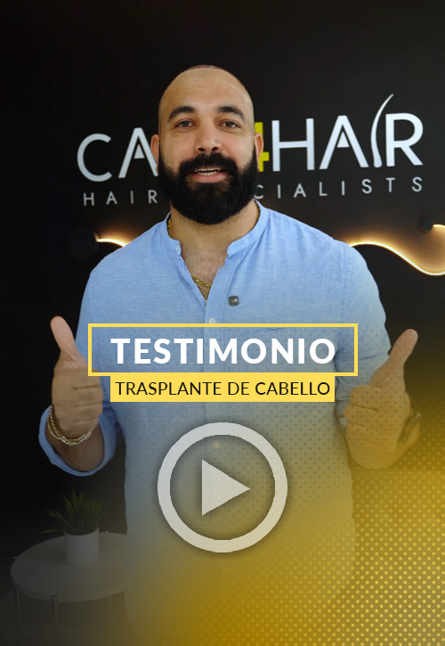 Testimonio de Yendy Ramos después de su restauración capilar en Miami | Care4Hair