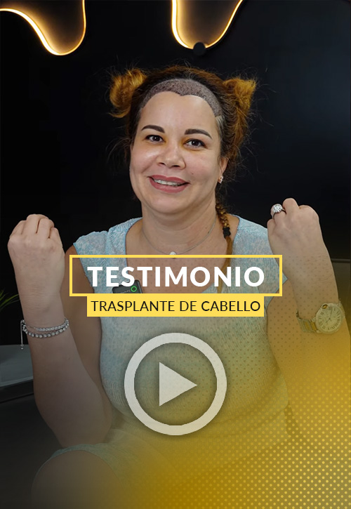 Testimonio de una Paciente mujer tras su restauración capilar en Miami