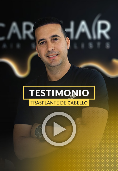 Video Testimonio de Rafael Paciente de Trasplante de Cabello