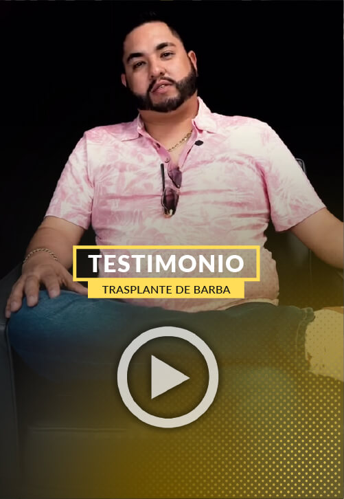 Testimonio de Aldo - Trasplante de Barba 7 meses despues