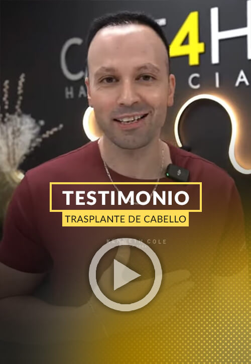 Transformación increíble con Care4Hair | ¡Recupera tu cabello y confianza!