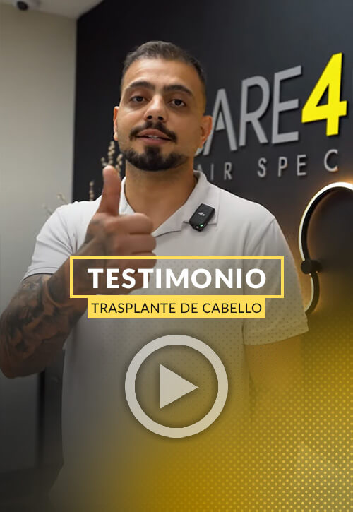 Testimonio de Alberto uno de nuestros pacientes en Care4Hair