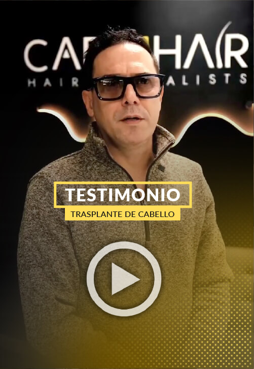 Video Testimonio - Transformacion con Trasplante de Pelo