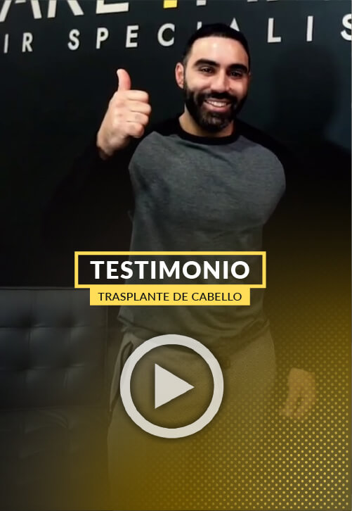 Testimonio de paciente que recupero su autoestima y su cabello en Care4Hair