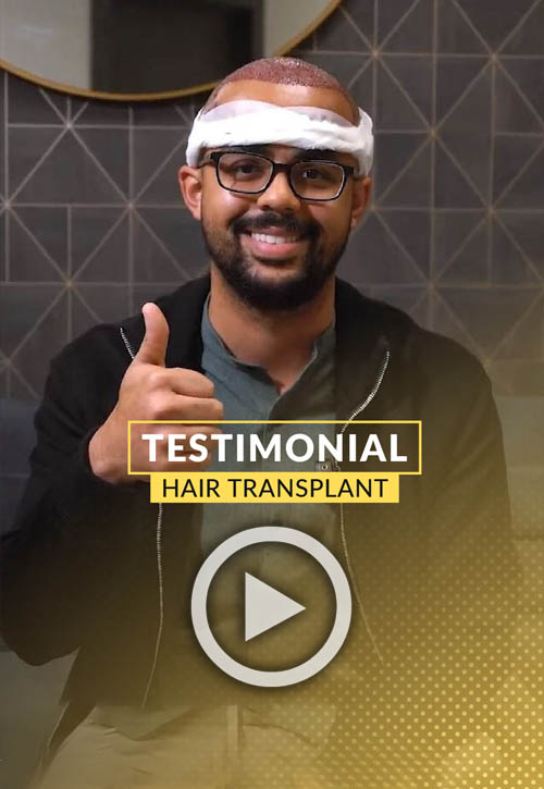 Lucas Guilherme Hair Transplant Video Testimony - 1 day post-op